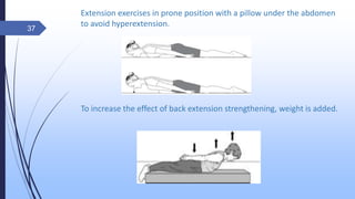 Extension exercises in prone position with a pillow under the abdomen
to avoid hyperextension.
To increase the effect of back extension strengthening, weight is added.
37
 