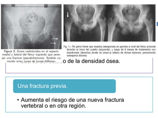 • Éstas no proporcionan información confiable
acerca del estado de la densidad ósea.
Las radiografías deben practicarse a todo
individuo con sospecha de osteoporosis.
• Aumenta el riesgo de una nueva fractura
vertebral o en otra región.
Una fractura previa.
 