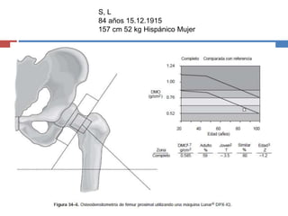 S, L
84 años 15.12.1915
157 cm 52 kg Hispánico Mujer
 