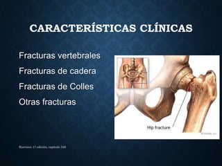 CARACTERÍSTICAS CLÍNICAS
Fracturas vertebrales
Fracturas de cadera
Fracturas de Colles
Otras fracturas
Harrison 17 edición, capitulo 348
 