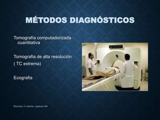 MÉTODOS DIAGNÓSTICOS
Tomografía computadorizada
cuantitativa
Tomografia de alta resolución
( TC extrema)
Ecografia
Harrison 17 edición, capitulo 348
 