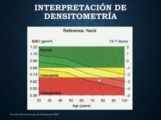 INTERPRETACIÓN DE
DENSITOMETRÍA
Consenso Iberoamericano de Osteoporosis 2009
 