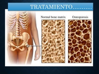 TRATAMIENTO………..
 