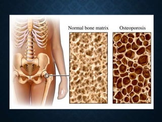 Harrison 17 edición, capitulo 348
 