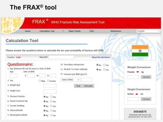 The FRAX® tool
 
