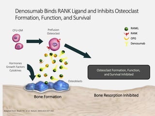 DenosumabBindsRANKLigandandInhibitsOsteoclast
Formation,Function,andSurvival
RANKL
RANK
OPG
Denosumab
Bone Formation Bone Resorption Inhibited
Osteoclast Formation, Function,
and Survival Inhibited
CFU-GM Prefusion
Osteoclast
Osteoblasts
Hormones
Growth Factors
Cytokines
Adapted from: Boyle WJ, et al. Nature. 2003;423:337-342.
 