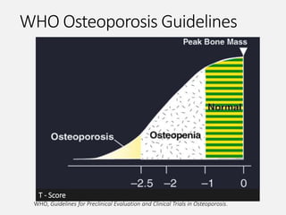 WHO, Guidelines for Preclinical Evaluation and Clinical Trials in Osteoporosis.
T - Score
WHO Osteoporosis Guidelines
 