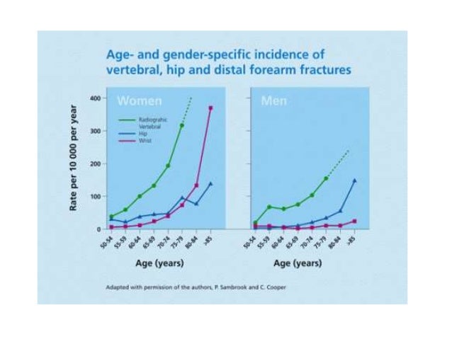 Horizon trial osteoporosis