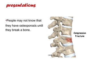 presentations
•People may not know that
they have osteoporosis until
they break a bone.
 
