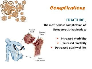 Complications
FRACTURE ,
The most serious complication of
Osteoporosis that leads to
 Increased morbidity
 Increased mortality
 Decreased quality of life
 