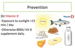 Prevention
(b) Vitamin D
-Exposure to sunlight >15
min / day
-Otherwise 800IU Vit D
supplement daily.
 