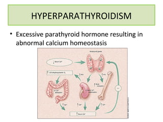 • Excessive parathyroid hormone resulting in
abnormal calcium homeostasis
HYPERPARATHYROIDISM
 
