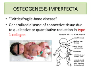 • “Brittle/fragile-bone disease”
• Generalized disease of connective tissue due
to qualitative or quantitative reduction in type
1 collagen
OSTEOGENESIS IMPERFECTA
 