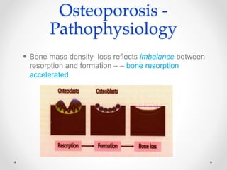 Osteoporosis -
Pathophysiology
 Bone mass density loss reflects imbalance between
resorption and formation – – bone resorption
accelerated
 