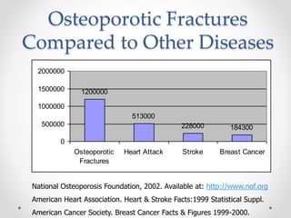 Osteoporotic Fractures
Compared to Other Diseases
1200000
513000
228000 184300
0
500000
1000000
1500000
2000000
Osteoporotic
Fractures
Heart Attack Stroke Breast Cancer
National Osteoporosis Foundation, 2002. Available at: http://www.nof.org
American Heart Association. Heart & Stroke Facts:1999 Statistical Suppl.
American Cancer Society. Breast Cancer Facts & Figures 1999-2000.
 