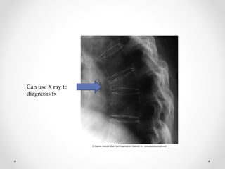 Can use X ray to
diagnosis fx
 