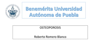 OSTEOPOROSIS
Roberto Romero Blanco
 
