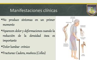 Manifestaciones clínicas
No produce síntomas en un primer
momento
Aparecen dolor y deformaciones cuando la
reducción de la densidad ósea es
importante
Dolor lumbar crónico
Fracturas: Cadera, muñeca (Colles)
 