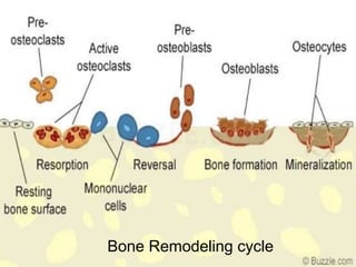 Bone Remodeling cycle
 
