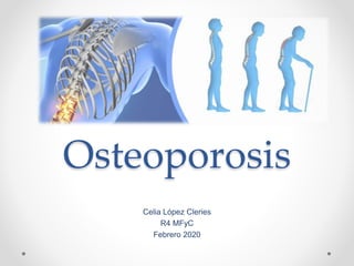 Osteoporosis
Celia López Cleries
R4 MFyC
Febrero 2020
 