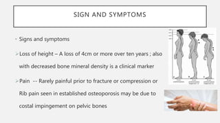 SIGN AND SYMPTOMS
• Signs and symptoms
Loss of height – A loss of 4cm or more over ten years ; also
with decreased bone mineral density is a clinical marker
Pain -- Rarely painful prior to fracture or compression or
Rib pain seen in established osteoporosis may be due to
costal impingement on pelvic bones
 