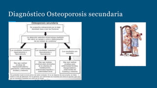 Diagnóstico Osteoporosis secundaria
 