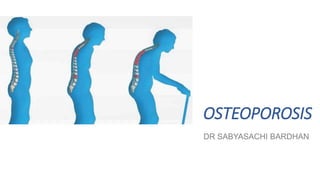 OSTEOPOROSIS
DR SABYASACHI BARDHAN
 