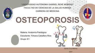 OSTEOPOROSIS
Materia: Anatomía Patológica
Estudiante: Yohana Caballero Rios
Grupo: E1
“UNIVERSIDAD AUTÓNOMA GABRIEL RENÉ MORENO”
FACULTAD DE CIENCIAS DE LA SALUD HUMANA
CARRERA DE MEDICINA
Santa Cruz-Bolivia
2021
 