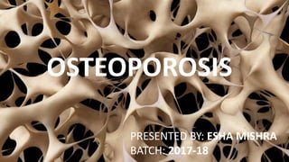 OSTEOPOROSIS
PRESENTED BY: ESHA MISHRA
BATCH: 2017-18
 