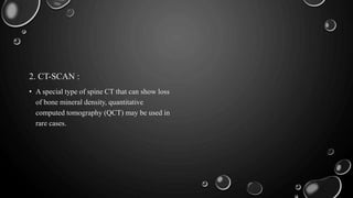 2. CT-SCAN :
• A special type of spine CT that can show loss
of bone mineral density, quantitative
computed tomography (QCT) may be used in
rare cases.
 