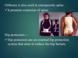 Orthoses is also used in osteoporotic spine .
It promote extension of spine.
Hip protectors :-
Hip protectors are an external hip protection
system that aims to reduce the hip facture.
 