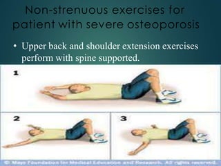 Non-strenuous exercises for
patient with severe osteoporosis
• Upper back and shoulder extension exercises
perform with spine supported.
 