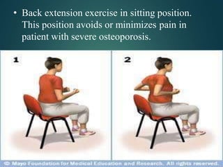 • Back extension exercise in sitting position.
This position avoids or minimizes pain in
patient with severe osteoporosis.
 