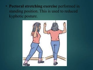 • Pectoral stretching exercise performed in
standing position. This is used to reduced
kyphotic posture.
 