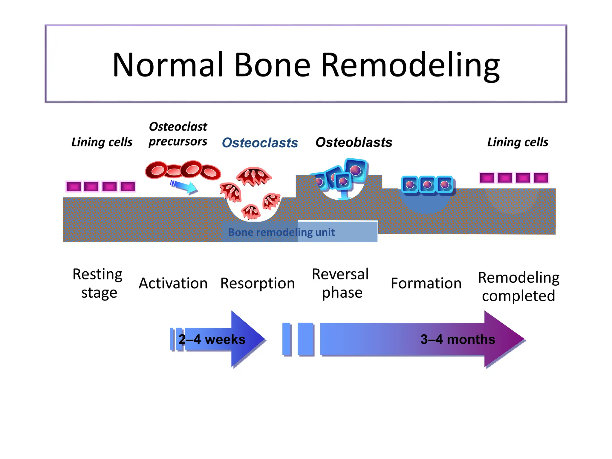 Osteoporosis in elderly causes and management | PPTX