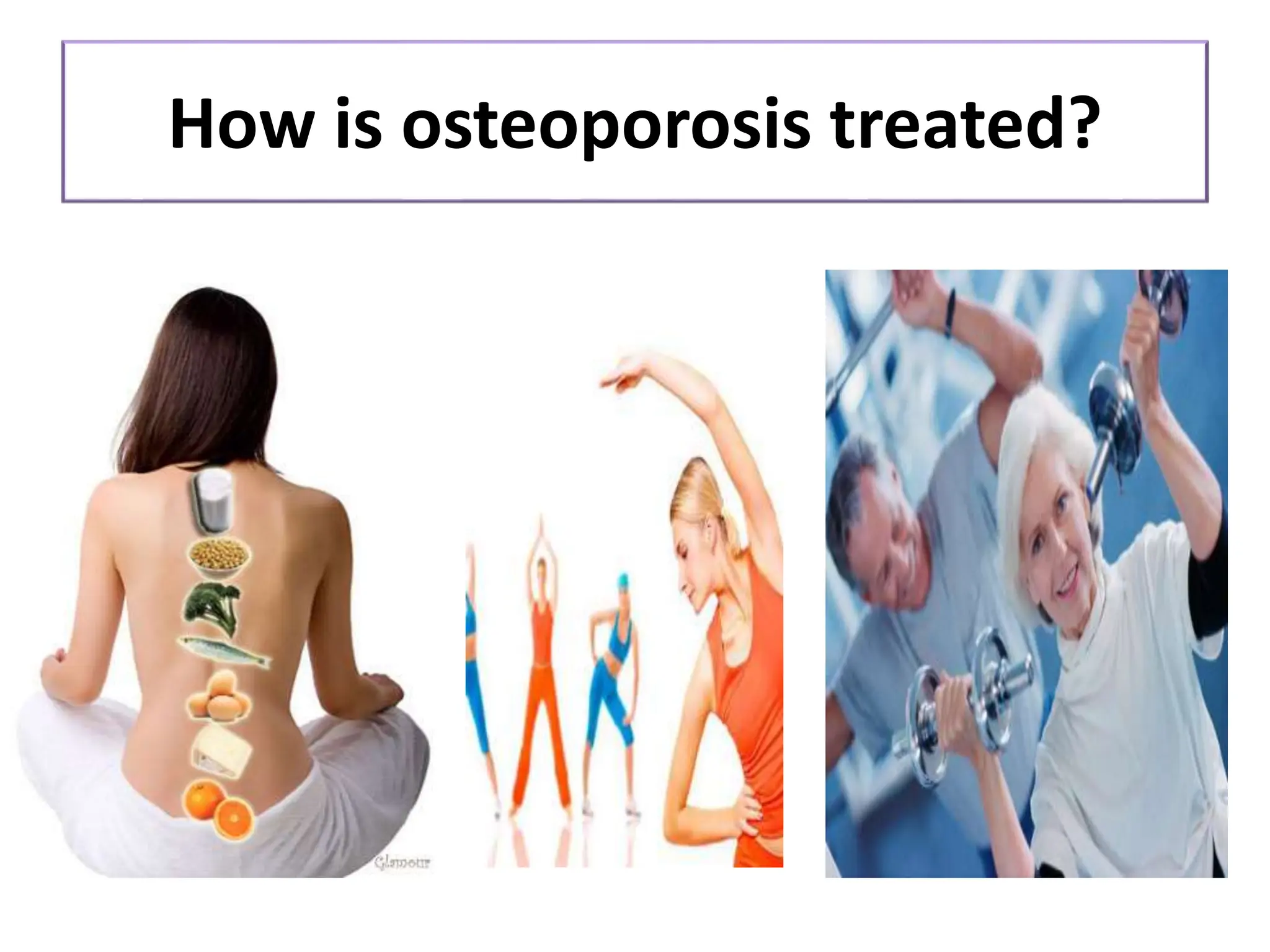 Osteoporosis in elderly causes and management | PPTX