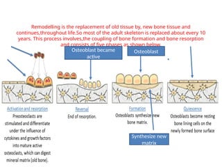 osteoporosisand treatmentand diagnosis withDEXA | PPT