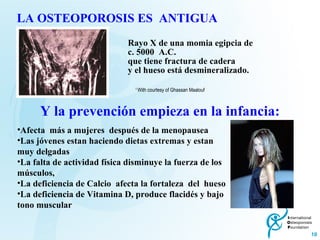 Y la prevención empieza en la infancia: LA OSTEOPOROSIS ES  ANTIGUA 1  With courtesy of Ghassan Maalouf  Afecta  más a mujeres  después de la menopausea  Las jóvenes estan haciendo dietas extremas y estan muy delgadas La falta de actividad física disminuye la fuerza de los músculos, La deficiencia de Calcio  afecta la fortaleza  del  hueso La deficiencia de Vitamina D, produce flacidés y bajo tono muscular Rayo X de una momia egipcia de  c. 5000  A.C.  que tiene fractura de cadera y el hueso está desmineralizado. 