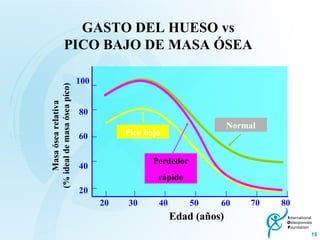 GASTO DEL HUESO vs  PICO BAJO DE MASA ÓSEA   Edad (años)  Masa ósea relativa (% ideal de masa ósea píco) 80 60 40 20 20 30 40 50 60 70 80 100 Pico bajo Perdedor rápido Normal 