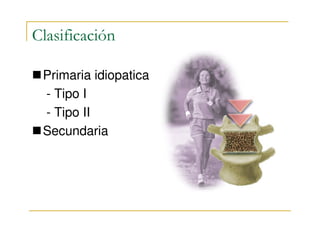 Clasificación

 Primaria idiopatica
 - Tipo I
 - Tipo II
 Secundaria
 