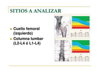SITIOS A ANALIZAR


 Cuello femoral
 (izquierdo)
 Columna lumbar
 (L2-L4 ó L1-L4)
 