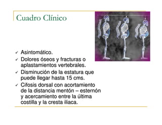 Cuadro Clínico


 Asintomático.
 Dolores óseos y fracturas o
 aplastamientos vertebrales.
 Disminución de la estatura que
 puede llegar hasta 15 cms.
 Cifosis dorsal con acortamiento
 de la distancia mentón – esternón
 y acercamiento entre la última
 costilla y la cresta iliaca.
 