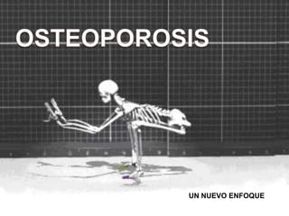 OSTEOPOROSIS UN NUEVO ENFOQUE UN NUEVO ENFOQUE 