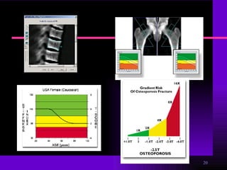 Osteoporosis y Osteopenia