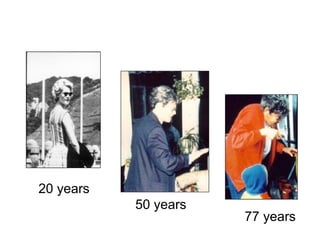 20 years
           50 years
                      77 years
 