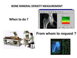 BONE MINERAL DENSITY MEASUREMENT



When to do ?



                From whom to request ?
 