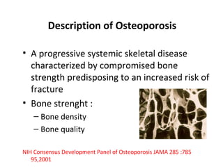 Description of Osteoporosis

• A progressive systemic skeletal disease
  characterized by compromised bone
  strength predisposing to an increased risk of
  fracture
• Bone strenght :
    – Bone density
    – Bone quality

NIH Consensus Development Panel of Osteoporosis JAMA 285 :785
   95,2001
 