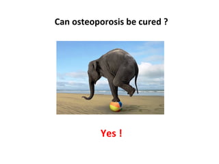 Can osteoporosis be cured ?




          Yes !
 