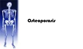 Osteoporosis
 