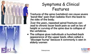 Symptoms & Clinical
Features
• Fractures of the spine (vertebra) can cause severe
"band-like" pain that radiates from the back to
the sides of the body.
• Over the years, repeated spinal fractures can
lead to chronic lower back pain as well as loss of
height or curving of the spine due to collapse of
the vertebrae.
• The collapse gives individuals a hunched-back
appearance of the upper back, often called a
"dowager hump" because it commonly is seen in
elderly women
12Osteoporosis
 